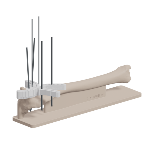 Products – OssAbility Limited