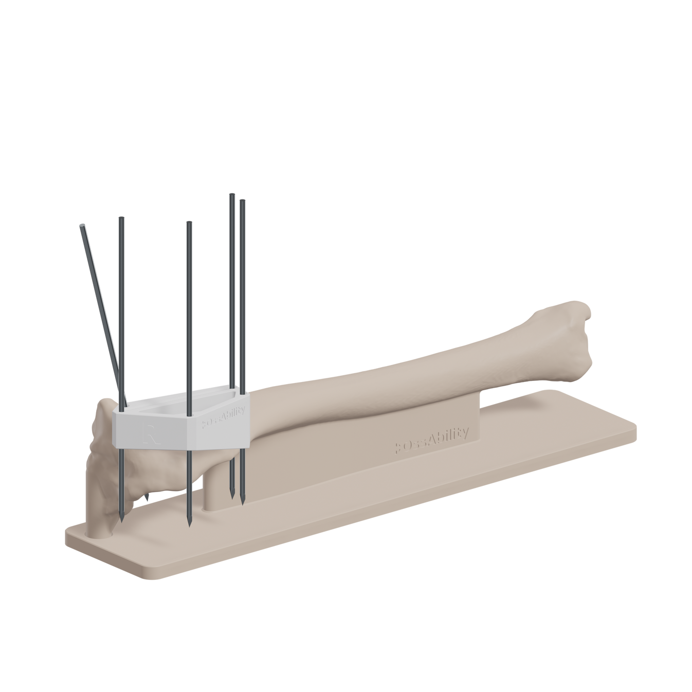 Patient Specific Guided TTA Training Kit – OssAbility Limited